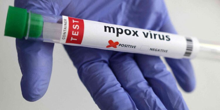 Britain detects two more cases of new mpox variant