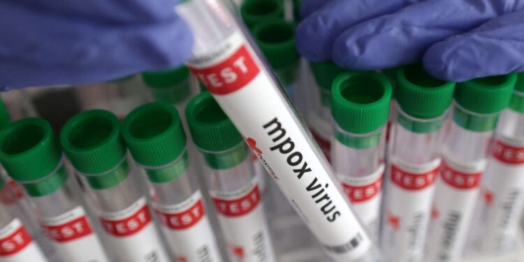 New ‘surprising’ case of mpox variant clade lb detected in England